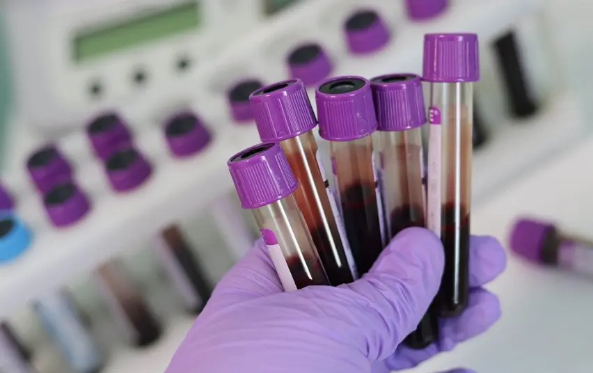 NVSC rekomenduoja pasitikrinti dėl ŽIV ir hepatitų