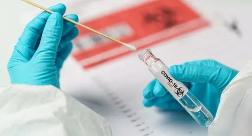 NVSC informuoja apie vasario 1 dienos COVID-19 protrūkius